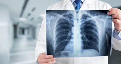 Безплатни прегледи за туберкулоза организира МБАЛ „Св. Пантелеймон“ – Ямбол от 8 до 12 декември.